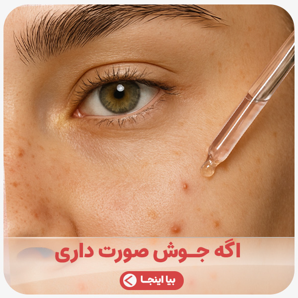 advertisment2